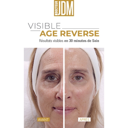 Exclusiva mundial: Tratamiento Visible Age Reverse